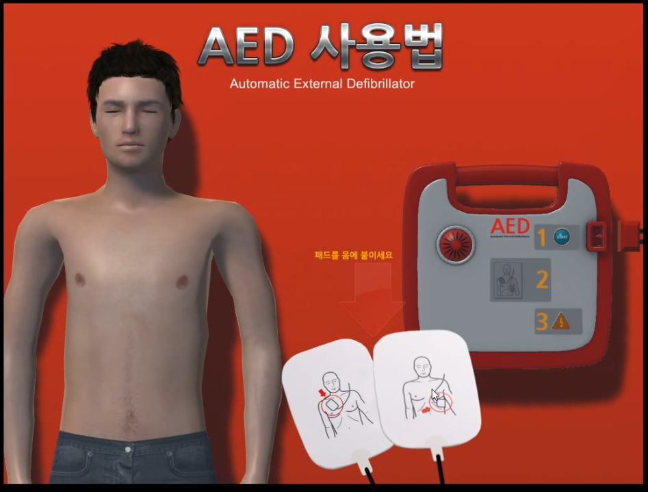 AED defibrillator